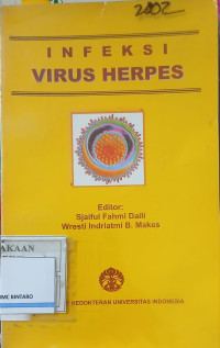 Image of Infeksi virus herpes